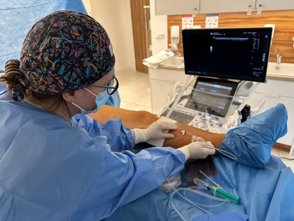 EVLT (Endovenous Laser Therapy) 
Total EVLA (modyfikacja EVLT)
Leczenie żylaków kończyn dolnych