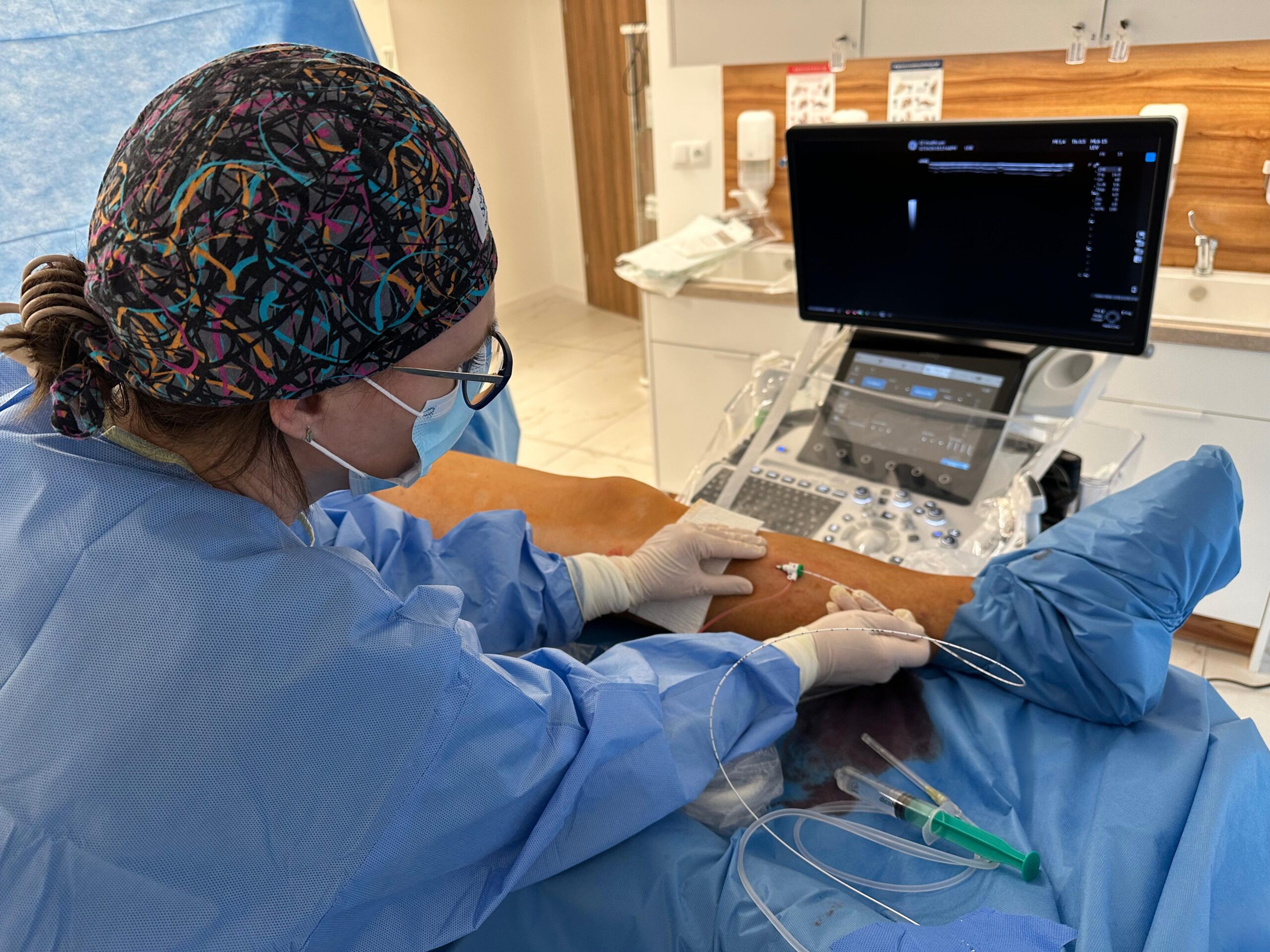 EVLT (Endovenous Laser Therapy)
Total EVLA (modyfikacja EVLT)
Leczenie żylaków kończyn dolnych